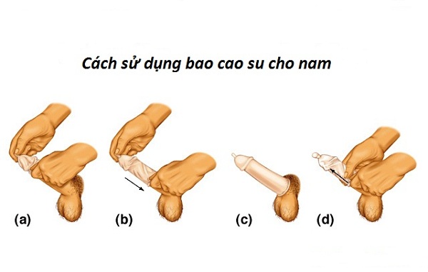 Bao cao su bi lớn gai li ti tăng khoái cảm cực sướng 5 chiếc