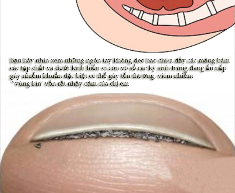 Bao cao su ngón tay an toàn cảm xúc, thăng hoa, chống viêm