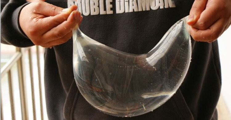 Bao cao su ngón tay an toàn cảm xúc, thăng hoa, chống viêm