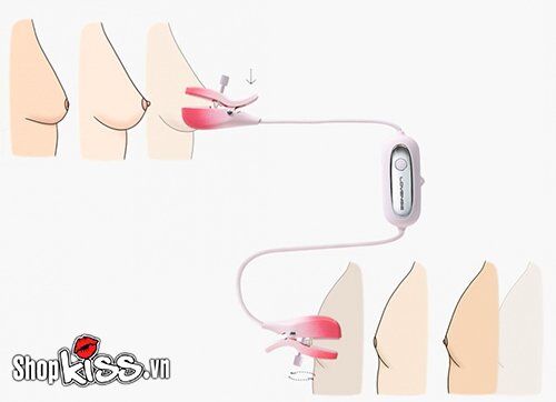 Bộ kẹp núm vú rung điều khiển từ xa Lovense Gemini cao cấp