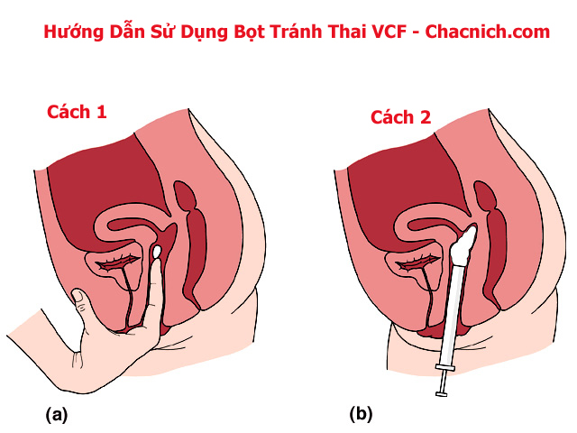 Gel tránh thai VCF an toàn hiệu quả không cần dùng bao cao su