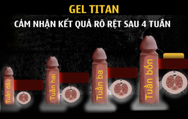 Titan Gel Nga chính hãng tăng kích thước cậu nhỏ nhanh chóng giảm giá