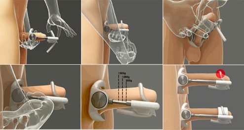 Máy tập Pro Extender kéo dài dương vật tự nhiên tăng kích cỡ hiệu quả