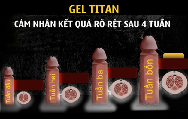 Titan Gel Nga Chính Hãng làm to tăng kích thước dương vật cậu nhỏ