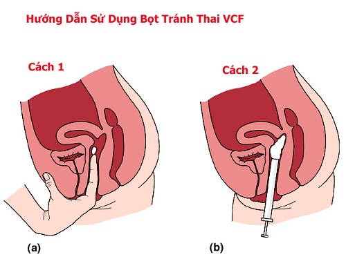  Bảng giá Màng phim tránh thai VCF an toàn và thoải mái với chuyện giường chiếu hàng mới về